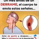 Señales de un Derrame Cerebral: Cómo Detectarlas a Tiempo
