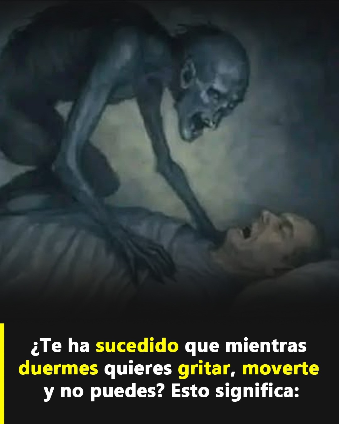Ilustración de parálisis del sueño