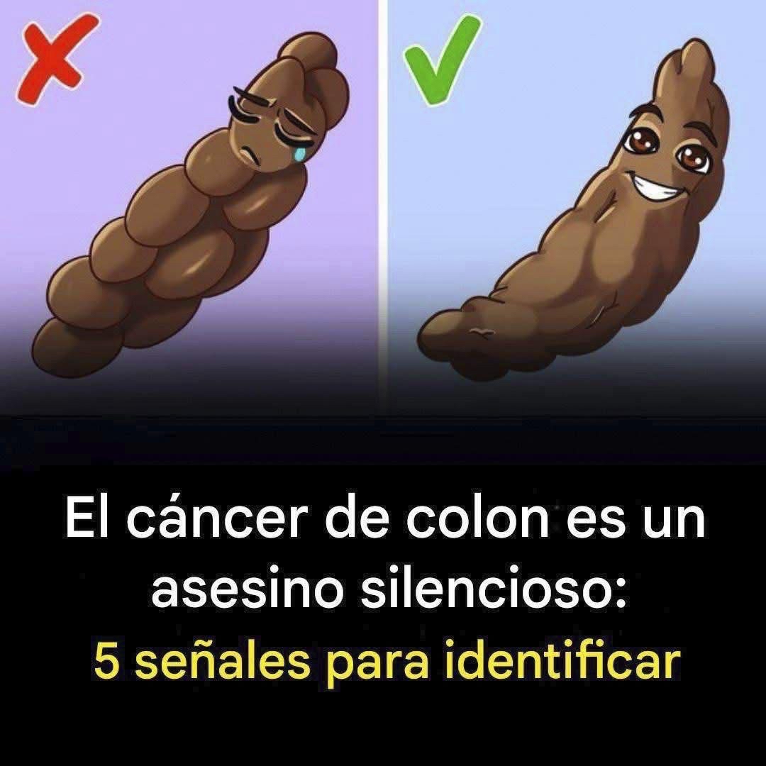 Señales de Cáncer de Colon