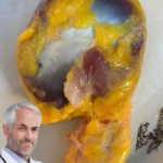 Beneficios de la Molleja de Pollo: Recetas, Salud y Remedios Caseros
