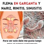 Elimina el Moco y la Flema con esta Receta Casera Efectiva