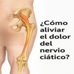 Adiós al Dolor Lumbar y Ciático: Técnicas Naturales para el Alivio