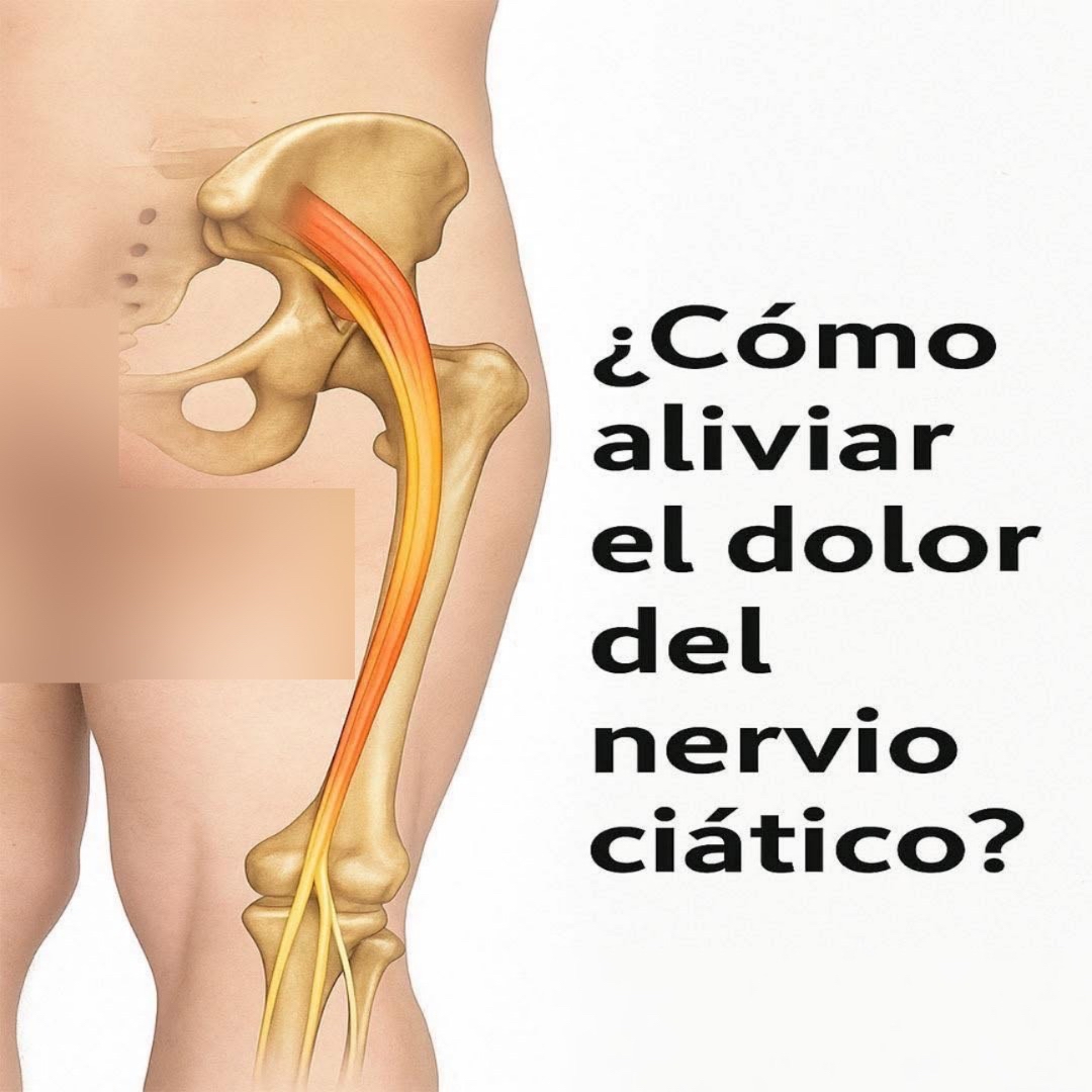 Ilustración anatómica de la cadera y el recorrido del nervio ciático