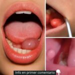 Signos de Inflamación Bucal y Remedios Naturales para Aliviar el Malestar