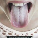 La Lengua Blanca: ¿Qué Significa y Cómo Mejorar tu Salud Bucal?