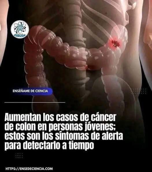 Colon humano con anomalía