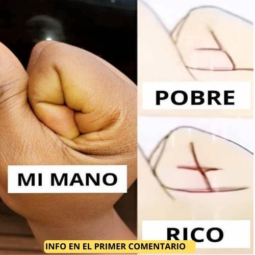 Cuidado de Manos