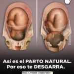 El Parto Natural: Lo Que Realmente Necesitas Saber