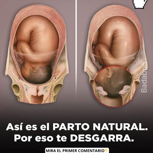 Ilustración sobre el proceso de parto natural