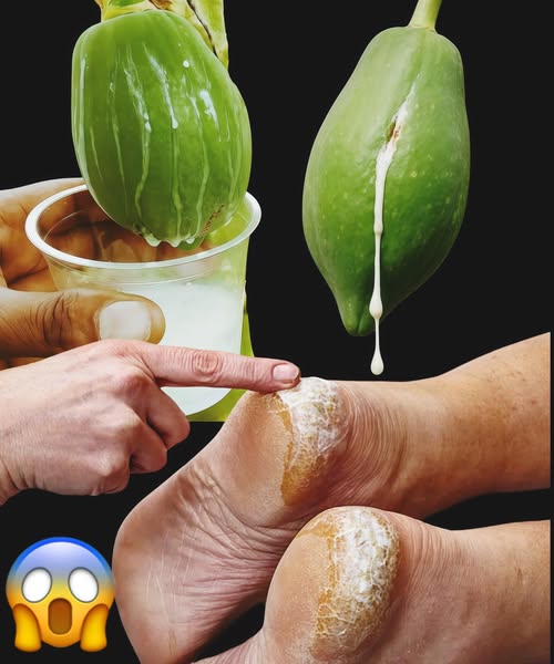 Tratamiento natural para talones agrietados con savia de papaya