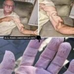 Cómo Manejar el Dolor Agudo en el Brazo y la Salud de Tus Manos