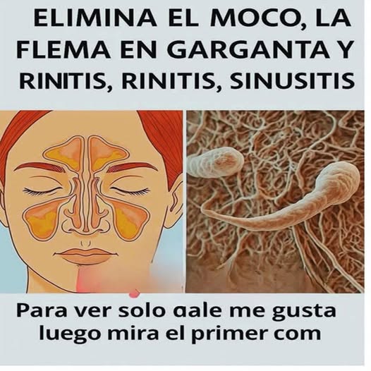 Senos paranasales y cilios en la mucosa nasal