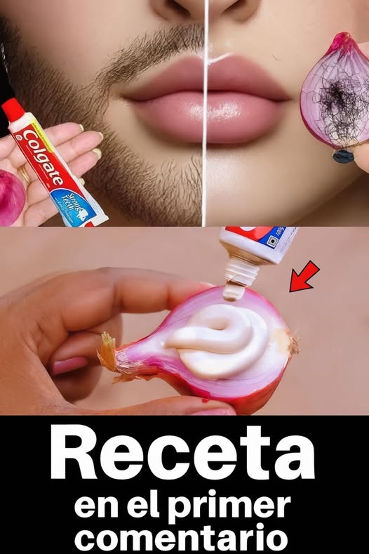 Remedio natural para eliminar vello facial y corporal