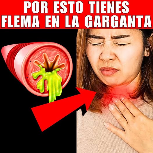 Remedios naturales para la flema