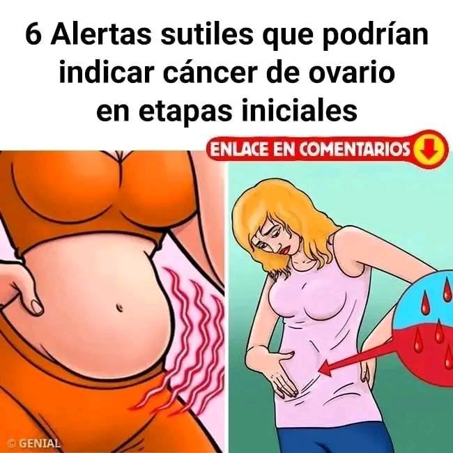 Síntomas del Cáncer de Ovario
