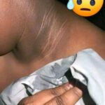 Cuello Negro: Razones, Causas y Remedios Naturales para Tratarlos