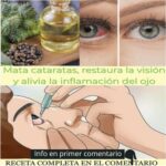 Remedio Natural para Ojos Secos y Cataratas