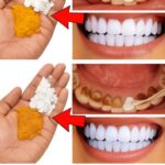 Blanqueamiento Dental en 2 Minutos: La Receta que los Dentistas No Quieren que Sepas