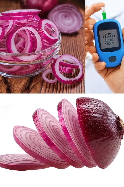 Cebolla Morada