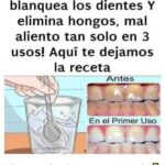 Elimina Hongos y Mal Aliento de Forma Natural