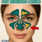 Alivio Natural para la Congestión: Quita el Moco y la Flema con Remedios Caseros