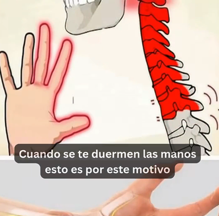 Mano adormecida