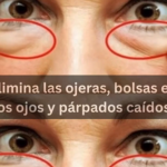 Elimina Ojeras, Bolsas y Párpados Caídos con Remedios Caseros Naturales