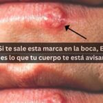 Remedios Naturales para Aftas y Herpes Bucales: Alivio Efectivo en Casa