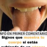 Cáncer de Estómago: Una Enfermedad Silenciosa y Recetas Naturales para la Salud