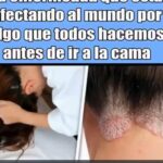 ¿Es Peligroso Dormir con el Cabello Mojado? Efectos en la Salud Capilar y Remedios Naturales