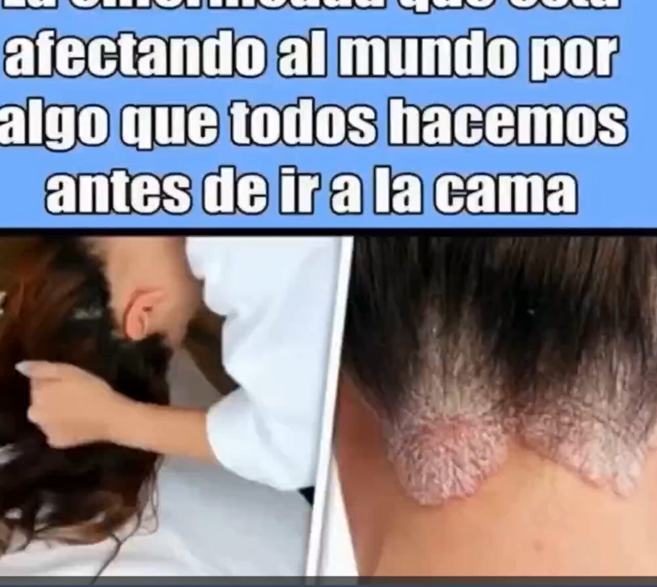 Cuidado del cabello mojado