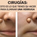 Elimina Verrugas de Forma Natural: Dos Métodos Efectivos