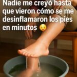 Soluciones Naturales para la Hinchazón de Pies y Mejora de la Circulación