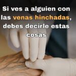 ¿Por qué Tienes las Venas Visibles en las Manos? Causas y Soluciones Naturales