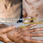 Descubre el Secreto del Selenio: El Mineral Esencial que Combate las Manchas de la Edad