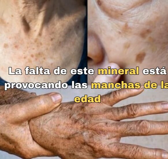Selenio y su influencia en la piel