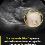 La Mano de Dios en una Ecografía: Un Mensaje de Esperanza y Protección