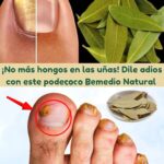 Dile Adiós a los Hongos con Este Poderoso Remedio Natural de Laurel