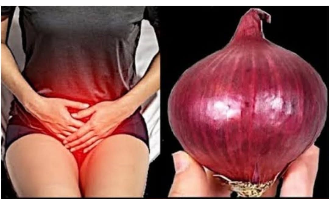 Cebolla Morada como remedio natural