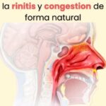 Elimina el Moco y la Flema: Remedios Caseros Efectivos
