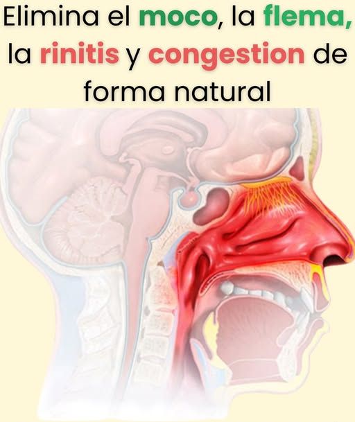 Gráfico sobre la salud respiratoria y áreas implicadas en moco y flema