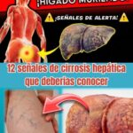 ¿Tu hígado está en peligro? 12 señales de cirrosis hepática que debes conocer