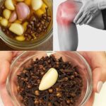 Remedios Naturales con Ajo y Clavo para el Dolor de Piernas