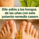 Dile Adiós a los Hongos en las Uñas con Este Poderoso Remedio Natural