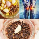 Alivio Natural del Dolor en las Piernas: Remedios Caseros con Ajo y Clavos de Olor