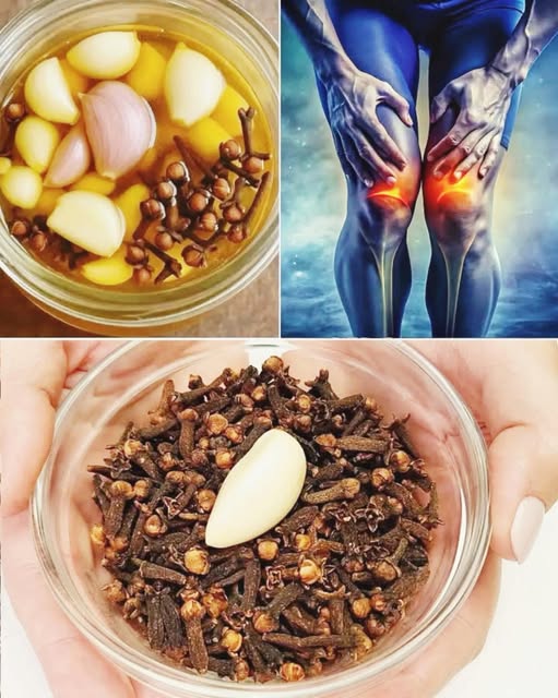 Preparación casera de ajo y clavos de olor para aliviar el dolor