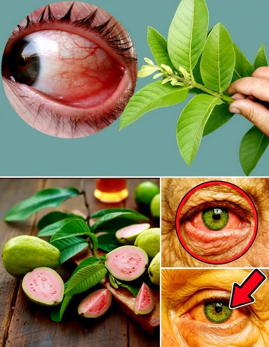 Hoja de guayaba como remedio natural para los ojos