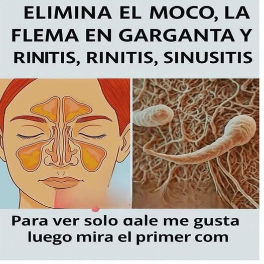 Senos paranasales y microorganismos
