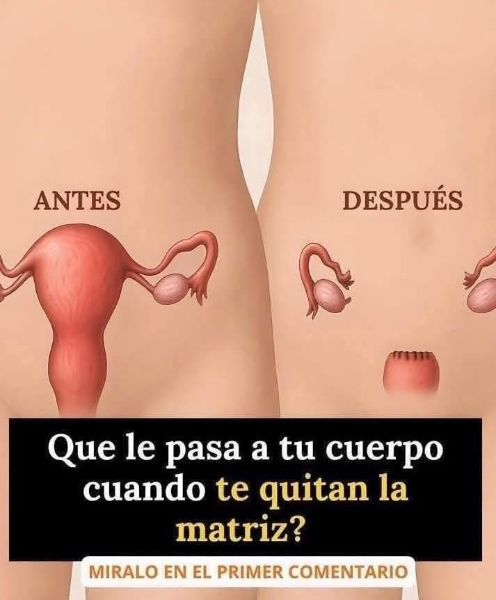 Comparación anatómica de antes y después de la histerectomía