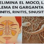 Elimina el Moco y la Flema: Remedios Caseros para Problemas Respiratorios